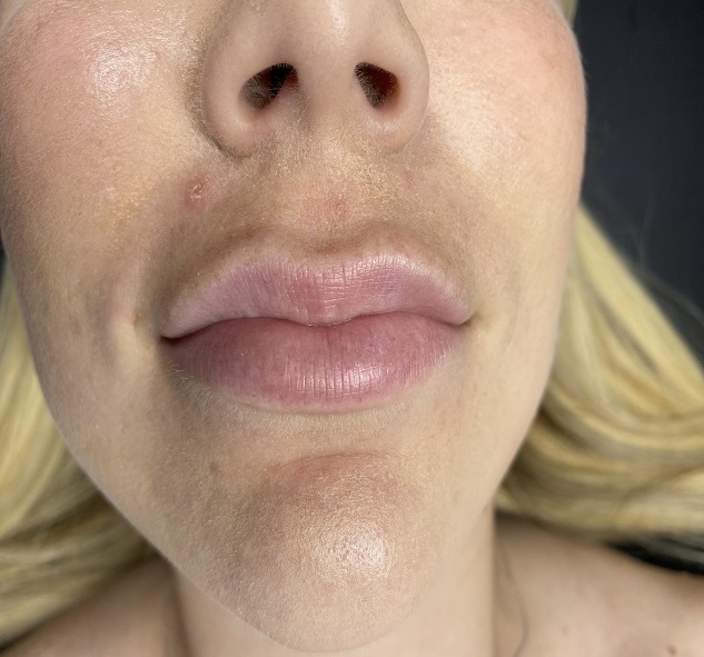 Lip Blushing Training Near Me Miami